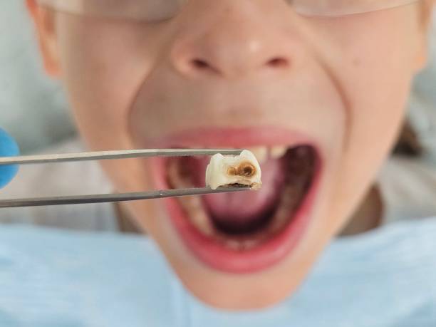 Best Emergency Dentist for Special Needs Patients in Ucon, ID